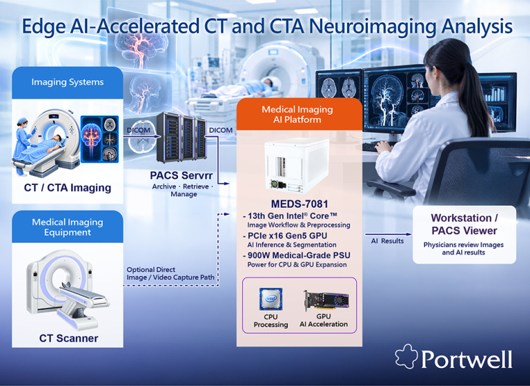 Edge AI Accelerates CT and CTA Neuroimaging Analysis